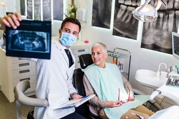 How Long Do All On   Implants Last?