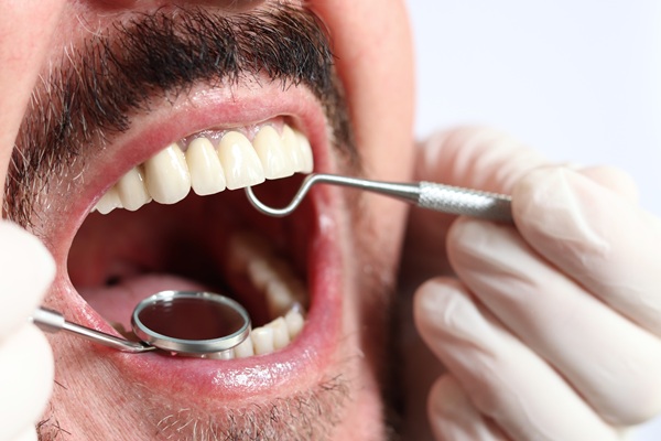 Which Cosmetic Dentistry Services To Implement First