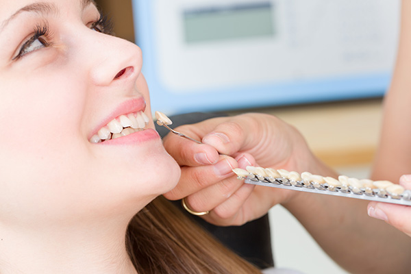 General Dentistry: Can Dental Veneers Help Restore Your Teeth? from Smile Center Dental Care in Federal Way, WA