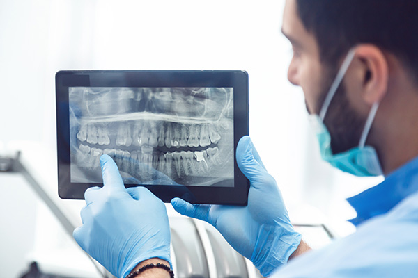 General Dentistry: Are Dental X-rays Recommended? from Smile Center Dental Care in Federal Way, WA