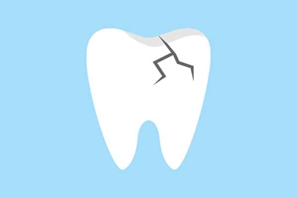 General Dentistry Treatments for a Damaged Tooth from Smile Center Dental Care in Federal Way, WA