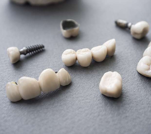 Federal Way The Difference Between Dental Implants and Mini Dental Implants