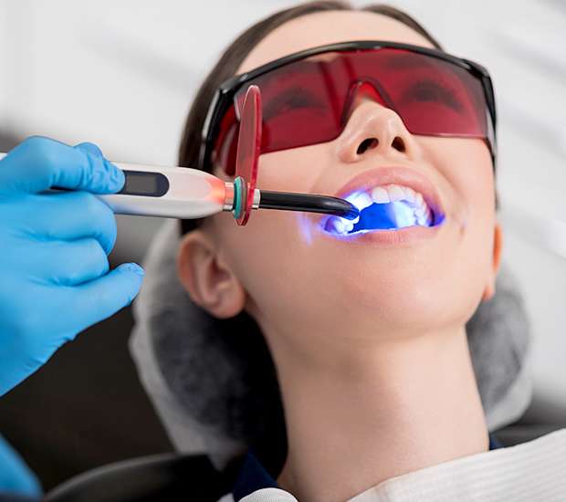 Federal Way Professional Teeth Whitening