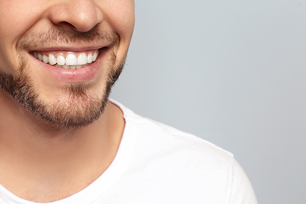 Teeth Whitening Treatments Performed by a General Dentist from Smile Center Dental Care in Federal Way, WA